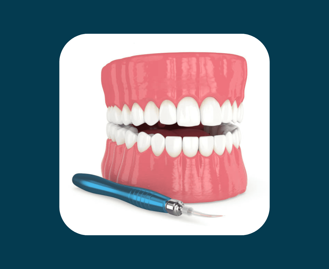 later treatment in orthodontics